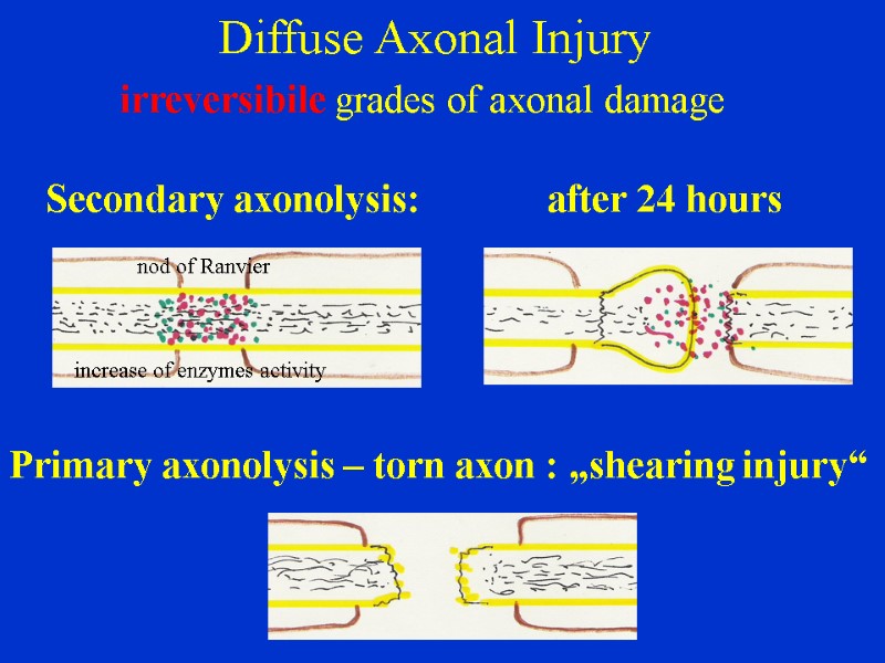 Diffuse Axonal Injury          irreversibile grades